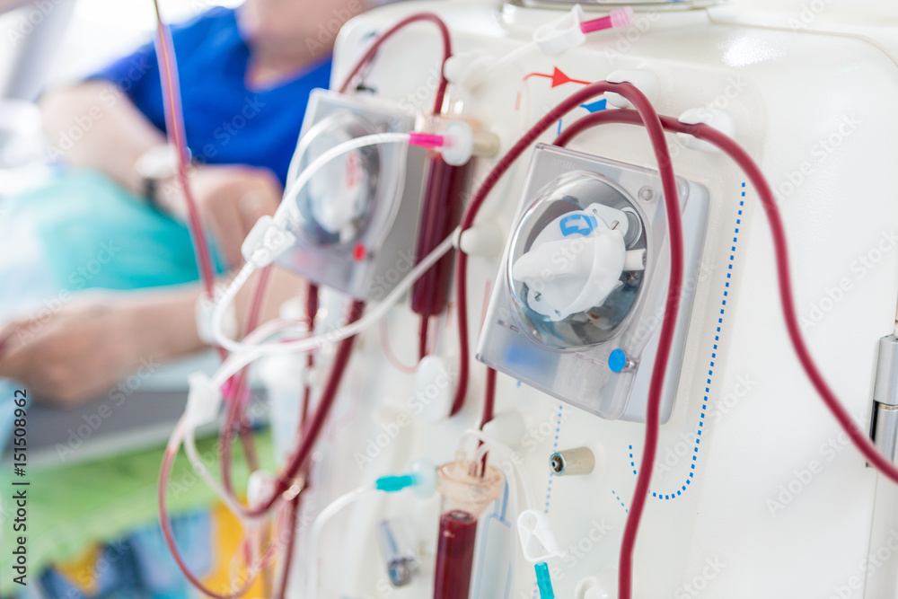 what is Dialysis?